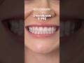 Премиальное отбеливание за 9.990ru. Подробнее в ТГ: 8969 0004040 Инста: yourclinic.ru