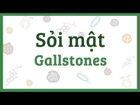 Bệnh sỏi mật - nguyên nhân, triệu chứng, chẩn đoán, điều trị & bệnh lý
