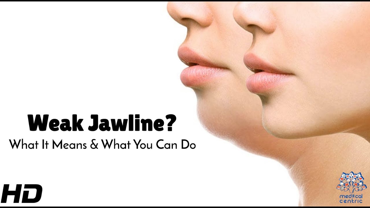 Fixing a Weak Jawline: Myths, Facts & Real Solutions - YouTube