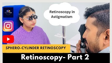 Retinoscopy Part 2 || Static Retinoscopy for astigmatism || Sphero-Cylinder method
