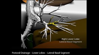 Postural Drainage: Lower Lobes - Lateral Basal Segment