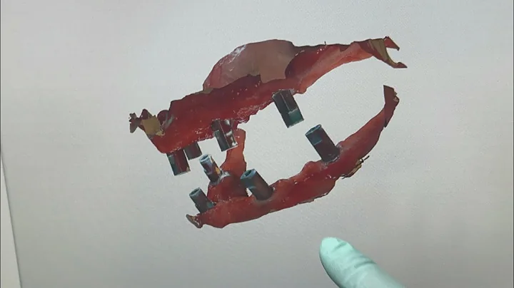 All on X - Full arch digital impression - Primescan Sirona - how simple it is