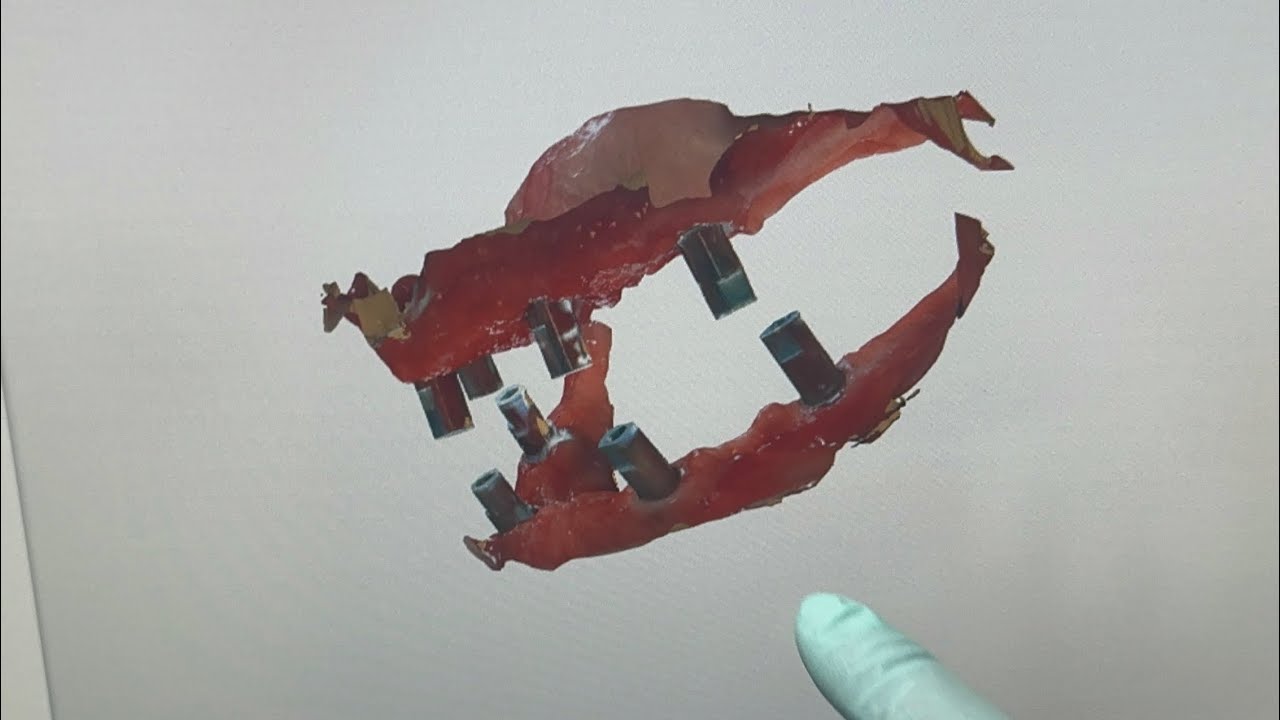 All on X - Full arch digital impression - Primescan Sirona - how simple it is