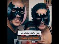معجزة طفلة قناع باتمان .. من الإستحالة للتحقق !