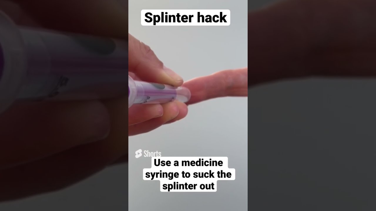 Remove a splinter with a kids medicine syringe. #splinter #firstaid #shorts