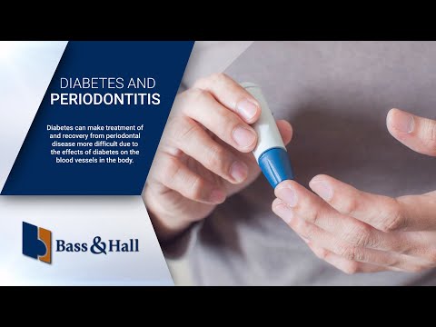 How Does Diabetes Affect Periodontal Disease?