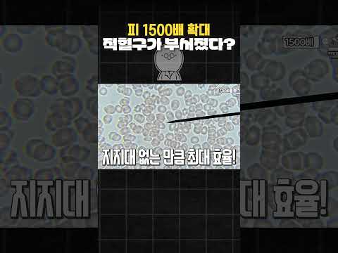 피를 1500배 현미경으로 확대 했더니...