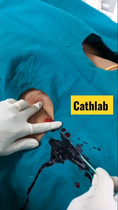 catheterization Lab procedure ❤️ 💯 👉 Doctor Dream ♥️ Neet motivation 💪 ✨️ #cathlab #shortvideo