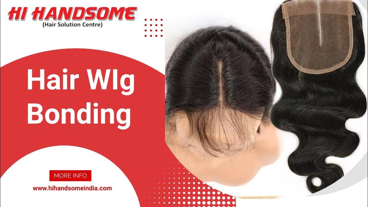 Hair Wig Patch For Women Hair Patch in Patna Hair Transplant in