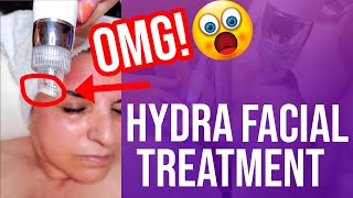 Hydra Facial with Chemical Peel Treatment | Guidance to Glow | Fenya Abramian