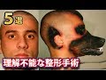 一般人には理解不能な整形手術をした人５選＋番外編