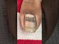 ASMR Nail Day Asmr Asmrvideos Satisfying Relax Relaxing Tingles Sleep Oddlysatisfying ASMR Nail Day Asmr Asmrvideos Satisfying Relax Relaxing Tingles Sleep Oddlysatisfying