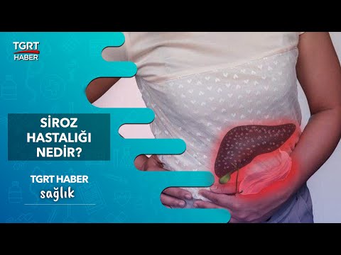 Siroz Hastalığı Nedir? Belirtileri nelerdir? Primer Biliyer Siroz Ne demek?