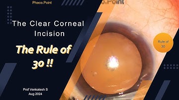 The clear Corneal Incision Creation -   THE RULE OF 