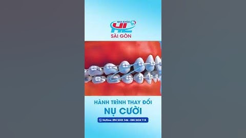 Hành trình thay nụ cười mới đều, rạng rỡ bằng phương pháp niềng răng tại Nha khoa Sài Gòn Hòa Long