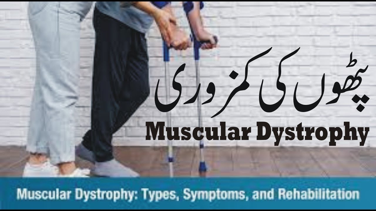 Muscular Dystrophy Paralysis Duchenne and Becker's dystrophy