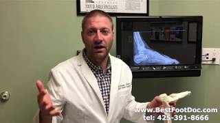 Calcaneal Fractures: A Brief Overview