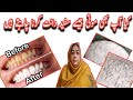 Teeth whitening at home fast  100 effective  yellow teeth natural remedy 