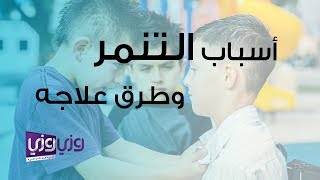 أسباب التنمر وطرق علاجه