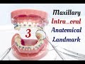 Prosthodontic_complete denture_lecture 2 _ intra-oral of the maxillary 2التركيبات المتحركة_المحاضرة
