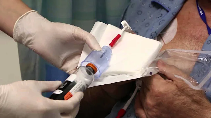 Should blood cultures be drawn from central lines? (2023)