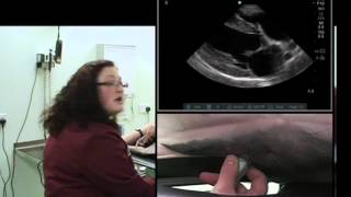 IMV imaging cardiac ultrasound video 4  Right parasternal long axis 4 chamber view