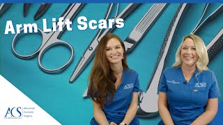 Arm Lift Surgery Scars: Types, Location, How to Hide Them, Healing Time & More!