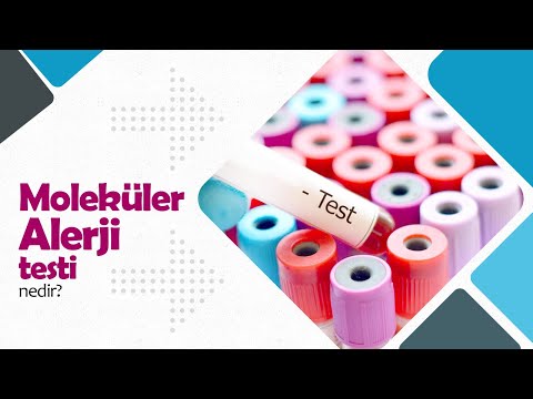 Moleküler Alerji Testi  Nedir?