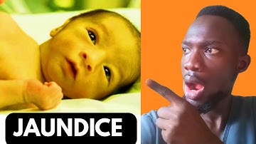 JAUNDICE IN NEWBORNS: What Every Parent Should Know About Neonatal Jaundice