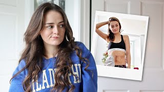 How I Got an Ostomy | Failed Intestinal Resection & Peritonitis at 16 | Let