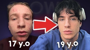 How To Look Like A Model As An Average Guy (Real life example)