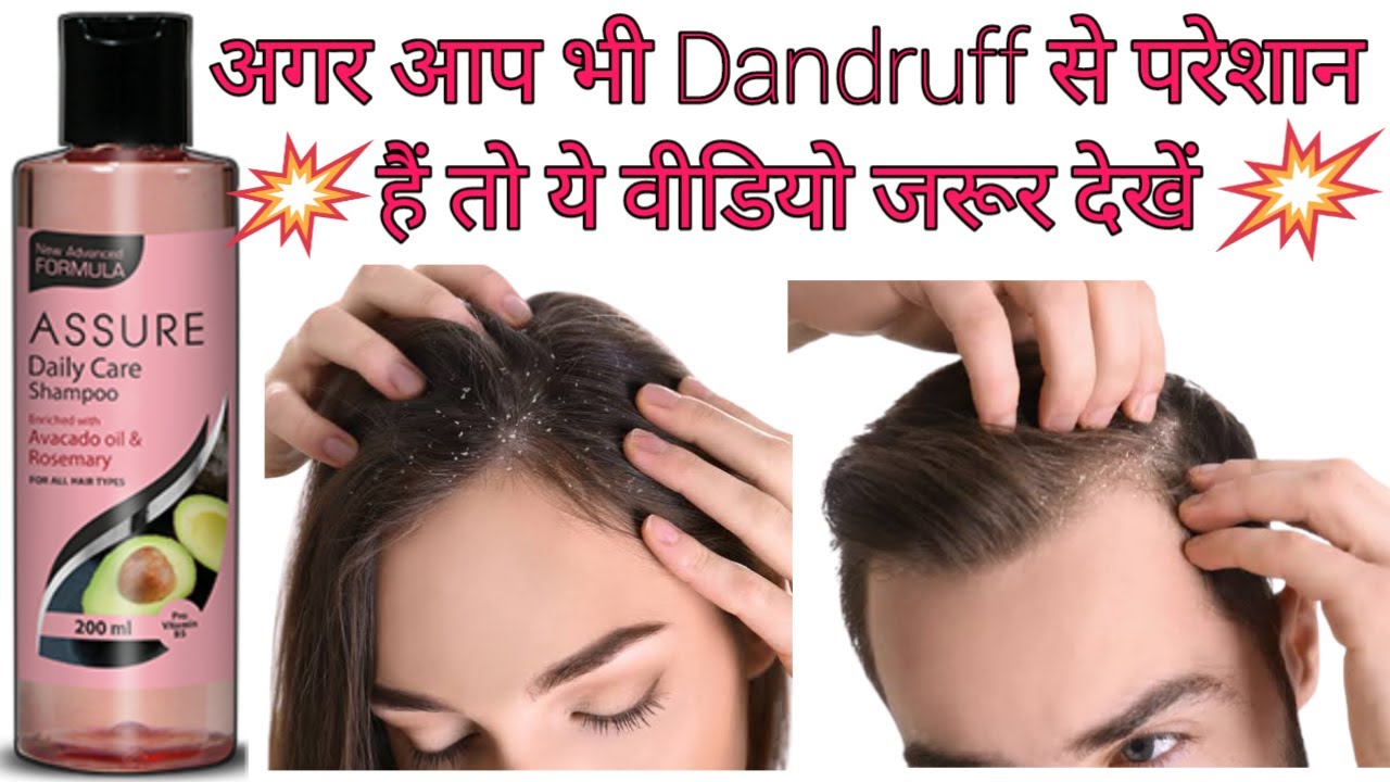 Assure Daily Care Shampoo के फायदे और नुकसान । In Hindi । How To use