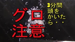 頭皮フケの悩みを持つ方必見！頭を3分間かきまっくた時のフケの量