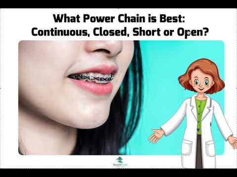 Replacing Old Power-Chain