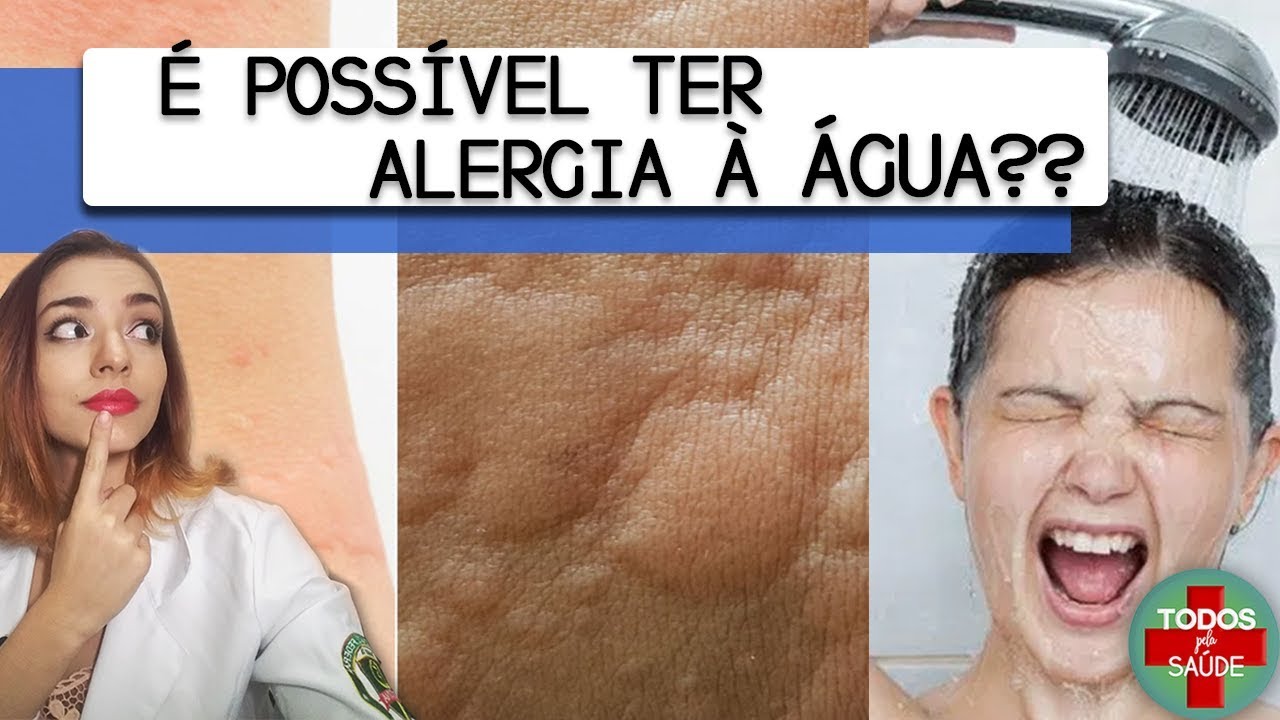 É POSSÍVEL TER ALERGIA À ÁGUA? - YouTube