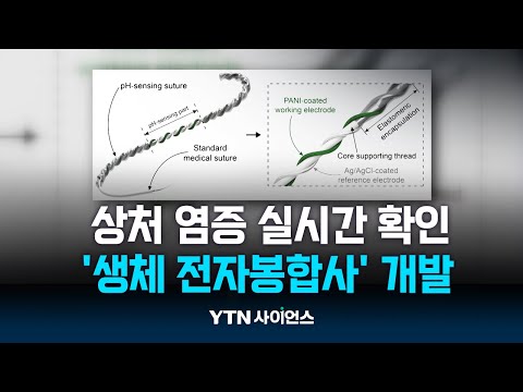 상처 부위 염증 실시간으로 확인 &amp;#39;생체 전자봉합사&amp;#39; 개발  | 과학뉴스 24.07.30