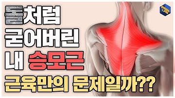 돌처럼 굳어버린 내 승모근 | 과연 근육만의 문제일까??