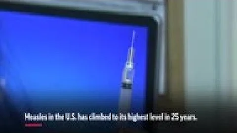 US measles cases hit highest mark in 25 years