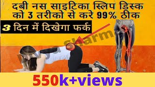 99% ठीक साइटिका,दबी नस,स्लिप डिस्क,कमर दर्द, sciatica pain relief,sciatica exercise,sciatica ka ilaj