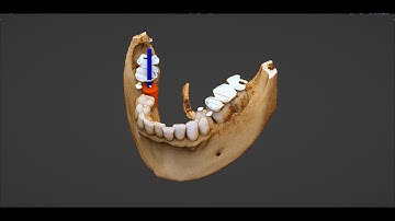 Bdental3 installation and setup