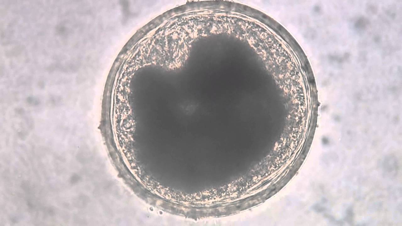 encysted-metacercaria-from-a-freshwater-mussel-40x-youtube