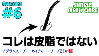 皮脂が毛穴に詰まると薄毛になる？～薄毛迷信⑥～