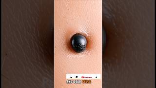 How Blackheads Secretly Form Inside Your Skin 😳⚠️ #shorts