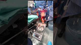 Happy Perfusion Week!