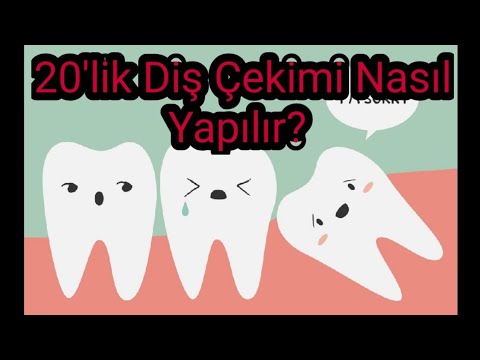 Video: Bir Lövhə Necə Aşındırılır