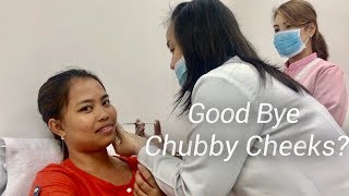 INSTANT FACE SLIM? (Chubby Cheeks Injection)