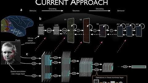 OHBM 2018 | Oral Session | Ravnoor Gill | Deep convolutional neural networks for detection of cort…