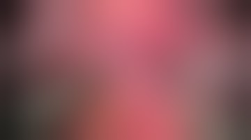 Laparoscopic Distal Esophagectomy, Proximal Gastrectomy With Roux-En-Y Reconstruction For ...