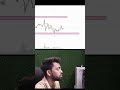 fresh chart analysis #trading #tradex #tradexbit #bitcoin #cryptotrading livetrading viral