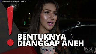 Barbie KumalasariRoy Kiyoshi Gagal Oplas, Perbaiki Wajah Berkalikali